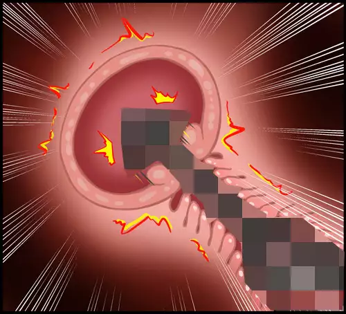 Install Core On Witches 18