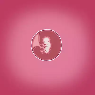 Yumi's Study Abroad/由美的留学生活（汉化）（连载中）